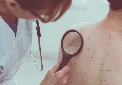 The Role of Dermatologists in Skin Cancer Prevention and Detection
