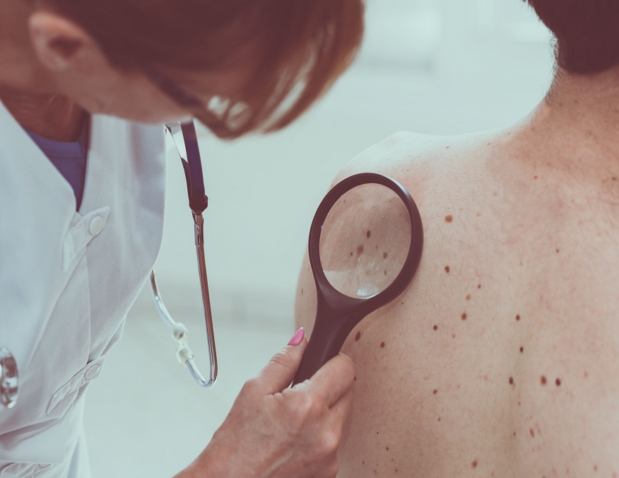 Dermatologists in Skin Cancer