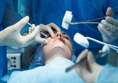 How to Choose the Right Plastic Surgeon for You