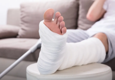 5 Tips To Ensure A Smooth Recovery After An Open Reduction Internal Fixation (ORIF) Surgery