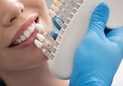 Everything You Should Know Regarding Dental Crowns and Bridges