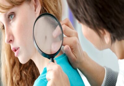 Conditions You Should Schedule An Appointment With A Dermatologist