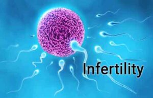  infertility